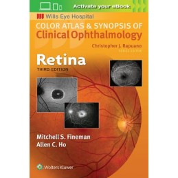 Retina