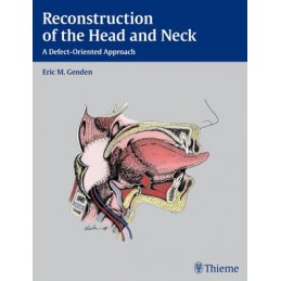 Reconstruction of the Head and Neck: A Defect-Oriented Approach