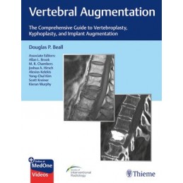 Vertebral Augmentation: The...