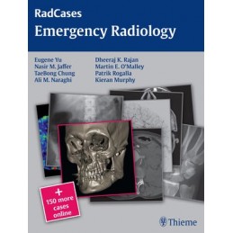 Radcases Emergency Radiology