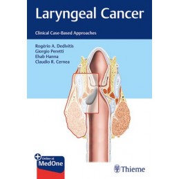 Laryngeal Cancer: Clinical Case-Based Approaches