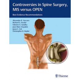 Controversies in Spine...