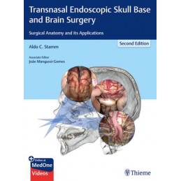 Transnasal Endoscopic Skull Base and Brain Surgery: Surgical Anatomy and its Applications