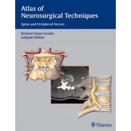 Atlas of Neurosurgical Techniques: Spine and Peripheral Nerves