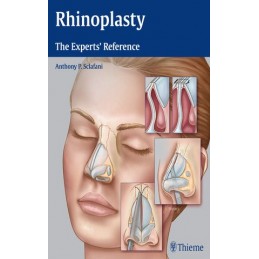 Rhinoplasty: The Experts' Reference