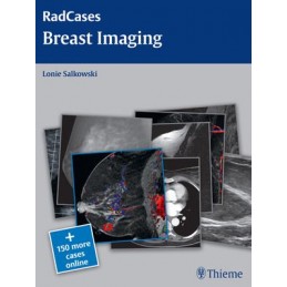 Radcases Breast Imaging