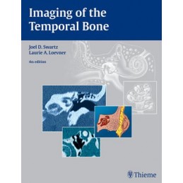 Imaging of the Temporal Bone