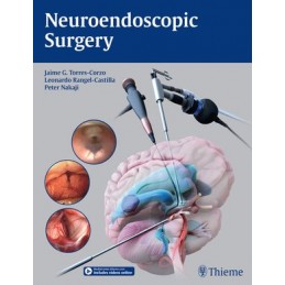 Neuroendoscopic Surgery