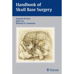 Handbook of Skull Base Surgery