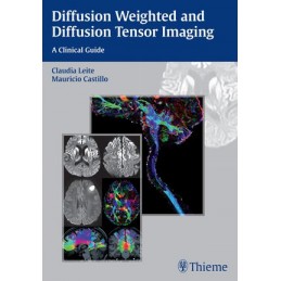 Diffusion Weighted and...