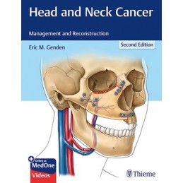 Head and Neck Cancer: Management and Reconstruction