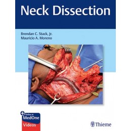 Neck Dissection