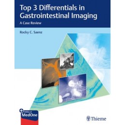 Top 3 Differentials in Gastrointestinal Imaging: A Case Review