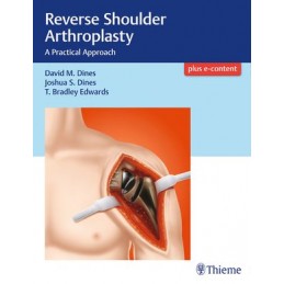 Reverse Shoulder...