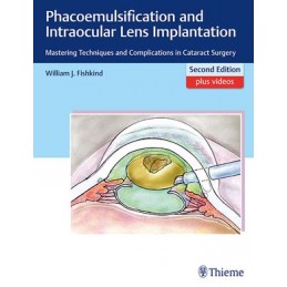 Phacoemulsification and...