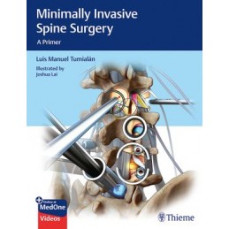 Minimally Invasive Spine...