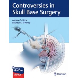 Controversies in Skull Base...