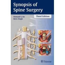 Synopsis of Spine Surgery