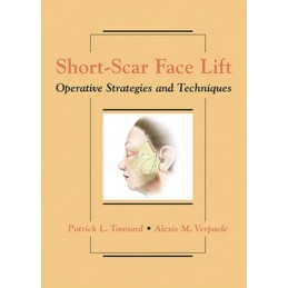 Short-Scar Face Lift: Operative Strategies and Techniques