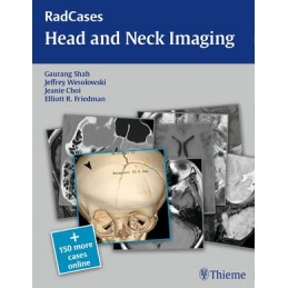 RadCases Head and Neck Imaging