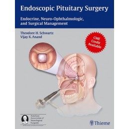 Endoscopic Pituitary Surgery: Endocrine, Neuro-Ophthalmologic, and Surgical Management