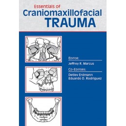 Essentials of Craniomaxillofacial Trauma