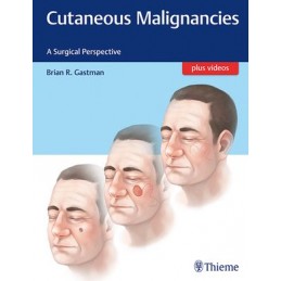 Cutaneous Malignancies: A Surgical Perspective