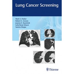 Lung Cancer Screening