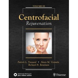 Centrofacial Rejuvenation