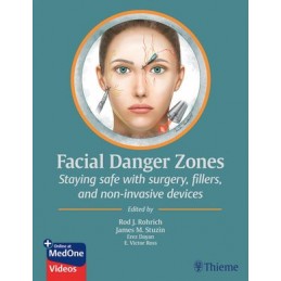 Facial Danger Zones: Staying safe with surgery, fillers, and non-invasive devices