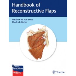 Handbook of Reconstructive Flaps