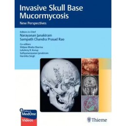 Invasive Skull Base Mucormycosis: New Perspectives