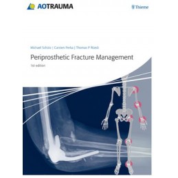 Periprosthetic Fracture...