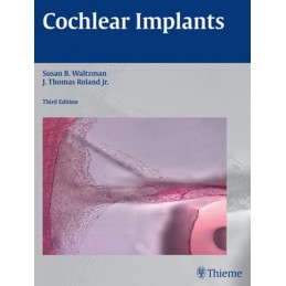 Cochlear Implants