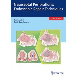 Nasoseptal Perforations: Endoscopic Repair Techniques