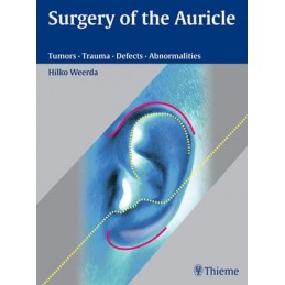 Surgery of the Auricle: Tumors-Trauma-Defects-Abnormalities