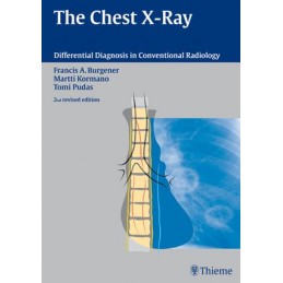 The Chest X-Ray