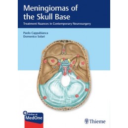 Meningiomas of the Skull Base: Treatment Nuances in Contemporary Neurosurgery