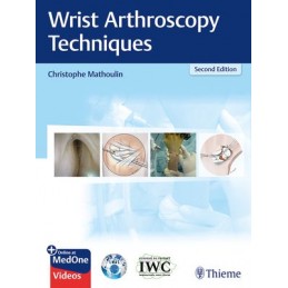 Wrist Arthroscopy Techniques