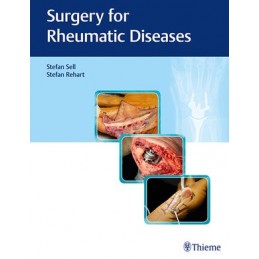 Surgery for Rheumatic Diseases