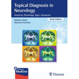 Topical Diagnosis in Neurology: Anatomy, Physiology, Signs, Symptoms