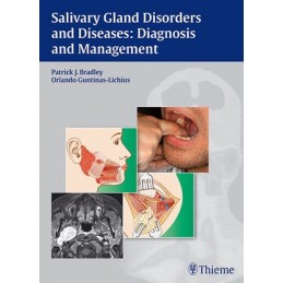 Salivary Gland Disorders and Diseases:: Diagnosis and Management