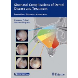 Sinonasal Complications of Dental Disease and Treatment: Prevention - Diagnosis - Management