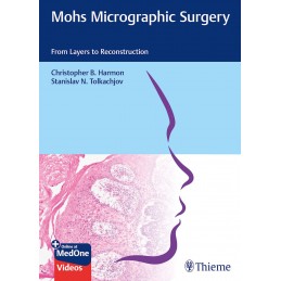 Mohs Micrographic Surgery:...