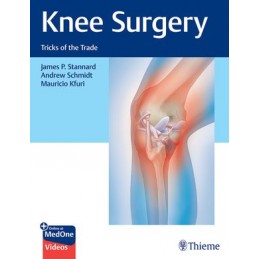 Knee Surgery: Tricks of the...