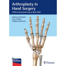 Arthroplasty in Hand...