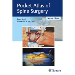 Pocket Atlas of Spine Surgery