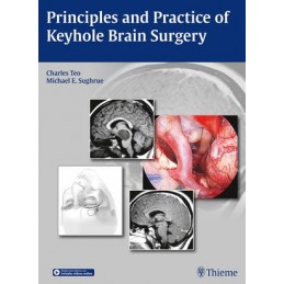 Principles and Practice of Keyhole Brain Surgery