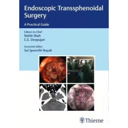 Endoscopic Transsphenoidal Surgery: A Practical Guide