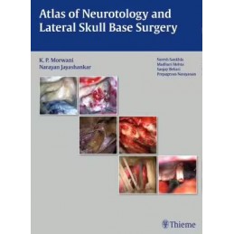 Atlas of Neurotology and Lateral Skull Base Surgery